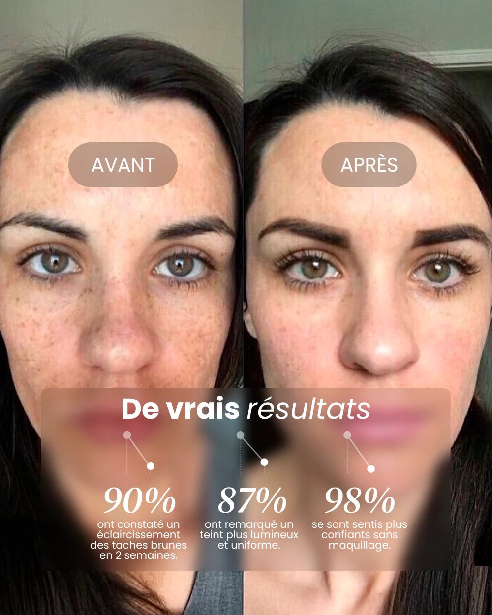 eliré - Correcteur de taches pour une luminosité visible