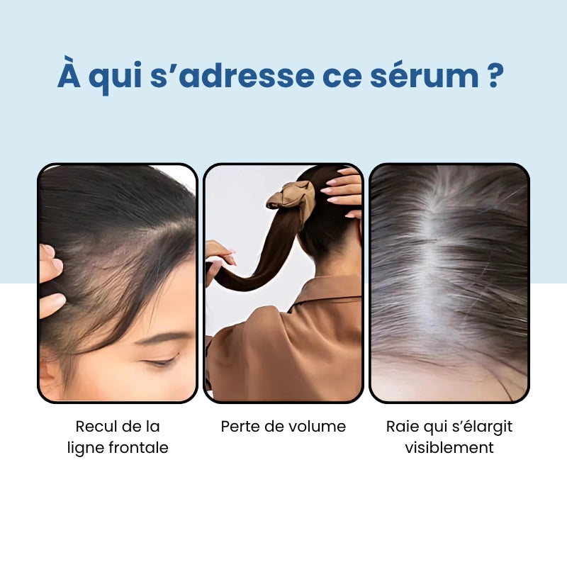Bodywise⎟Sérum Repousse Cheveux – Format Roll-On (25 ml)