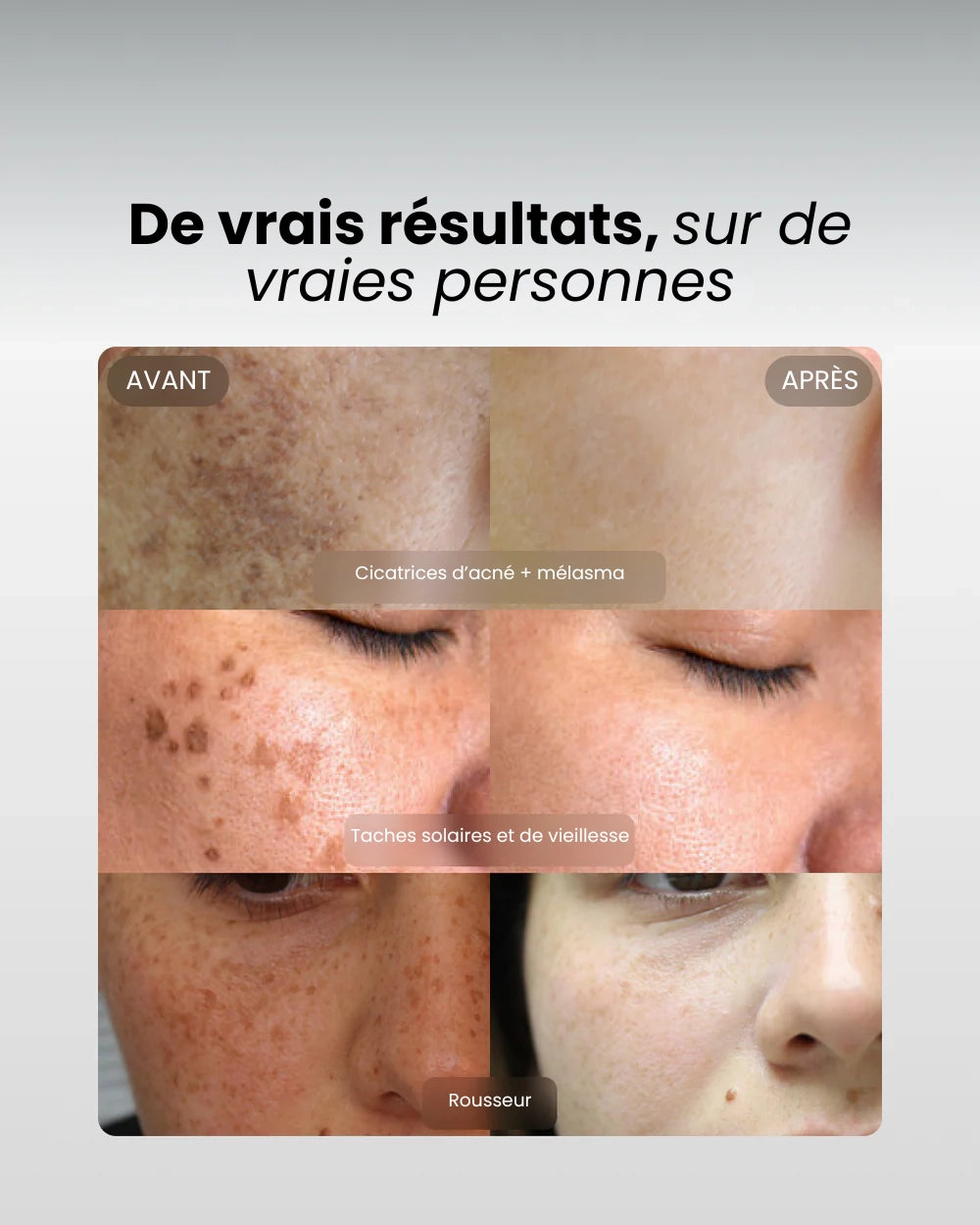 eliré - Correcteur de taches pour une luminosité visible