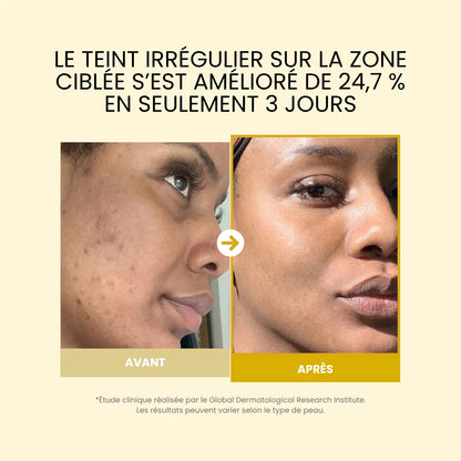 Masque de Nuit à l’Acide Kojique et au Curcuma