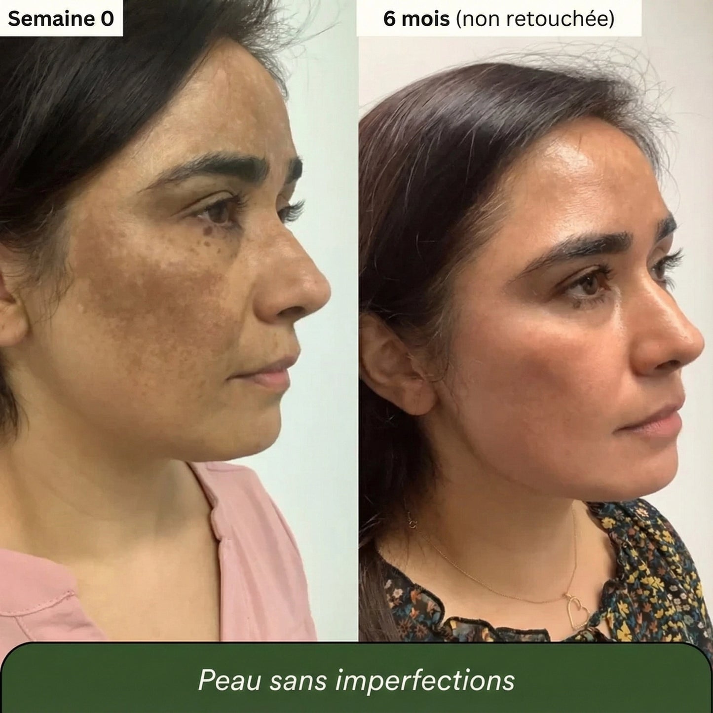 Savon au Curcuma et à l'Acide Kojique