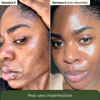 Savon au Curcuma et à l'Acide Kojique