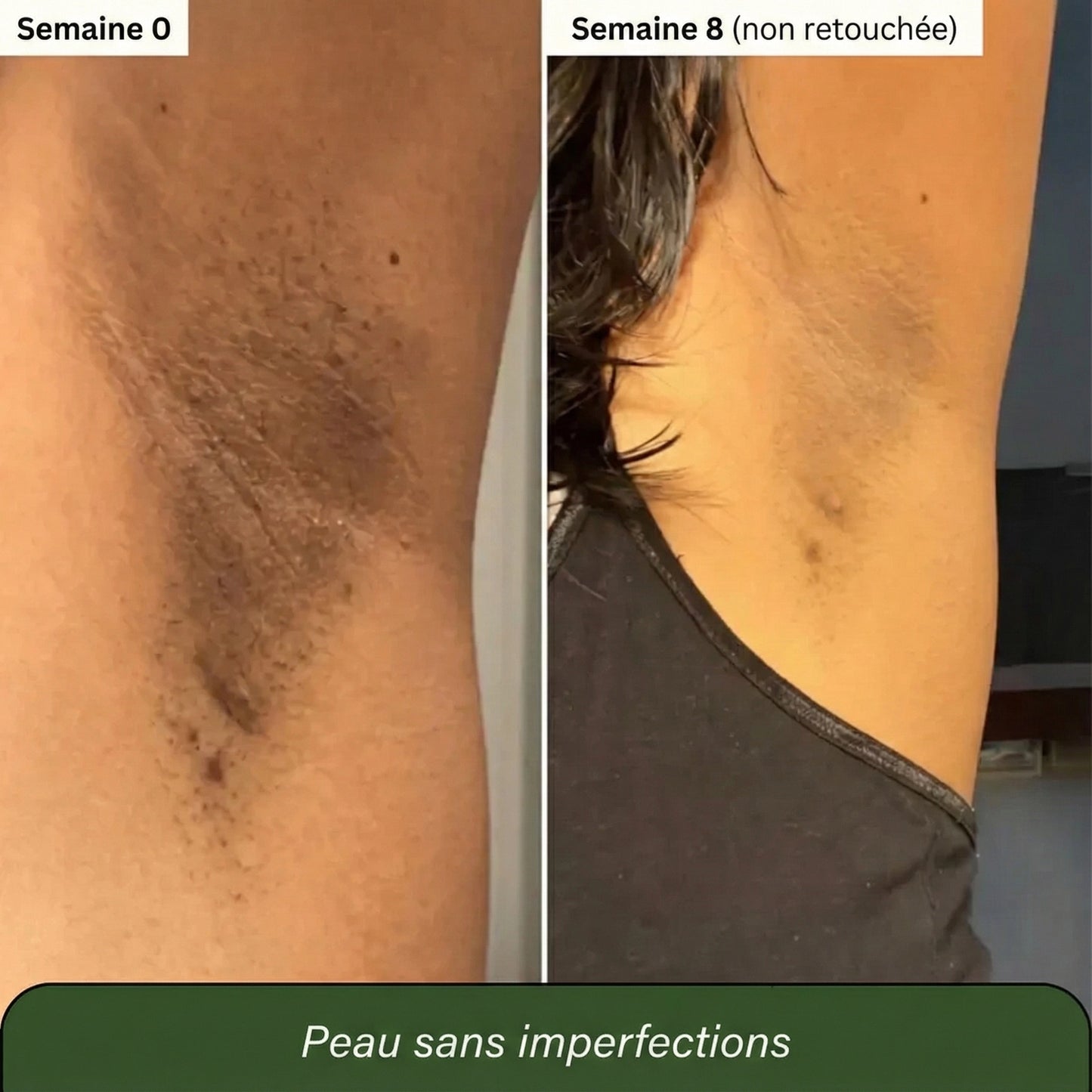 Savon au Curcuma et à l'Acide Kojique