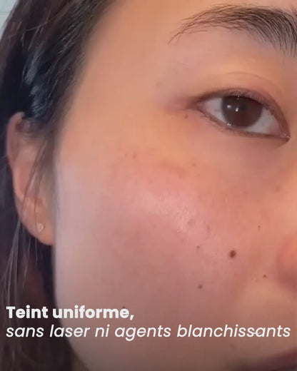 eliré - Correcteur de taches pour une luminosité visible