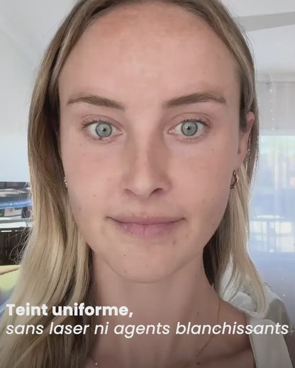 eliré - Correcteur de taches pour une luminosité visible