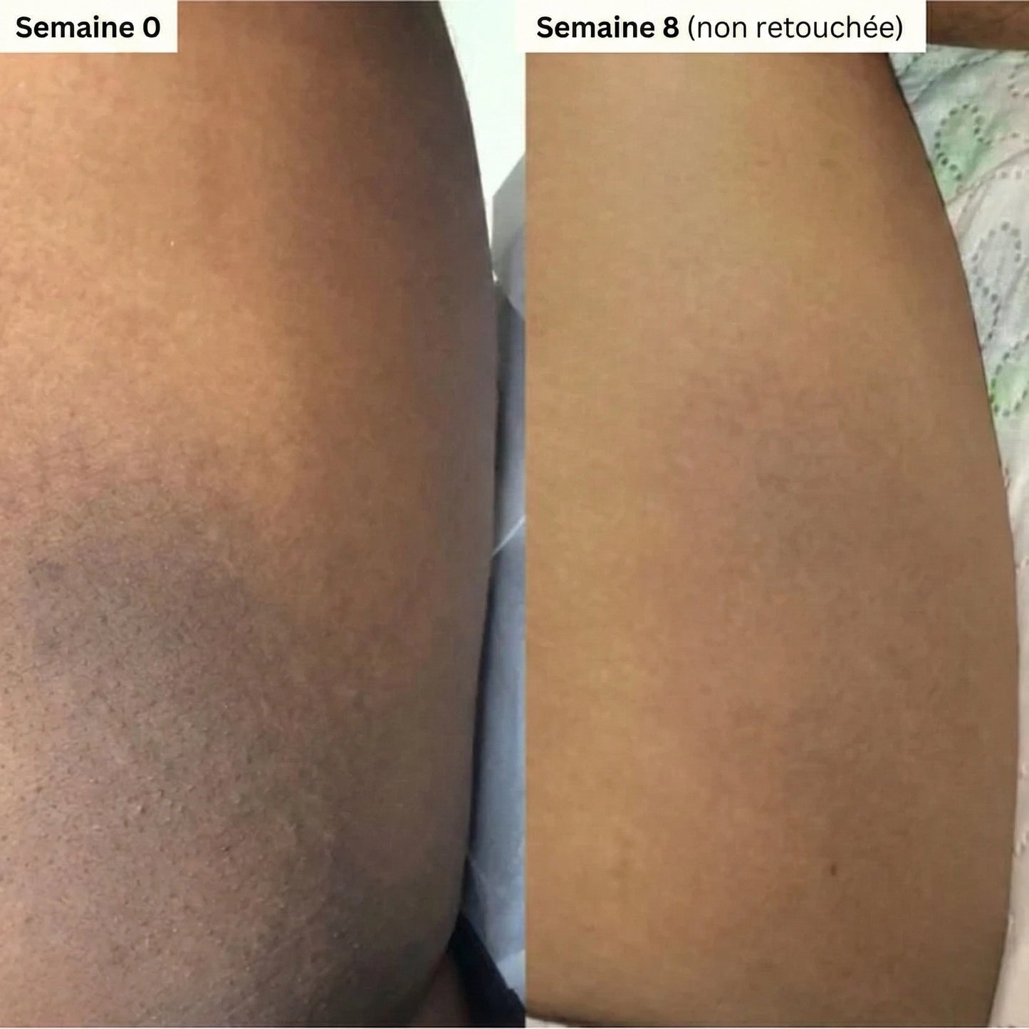 Savon au Curcuma et à l'Acide Kojique