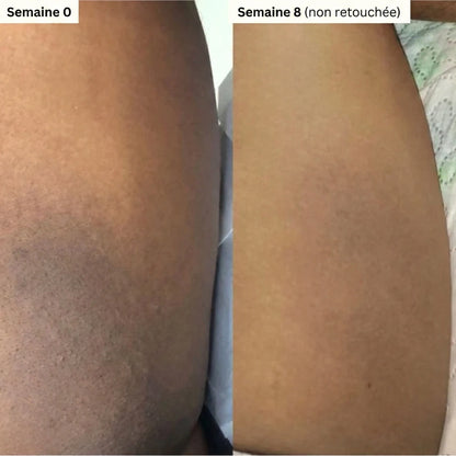 Savon au Curcuma et à l'Acide Kojique