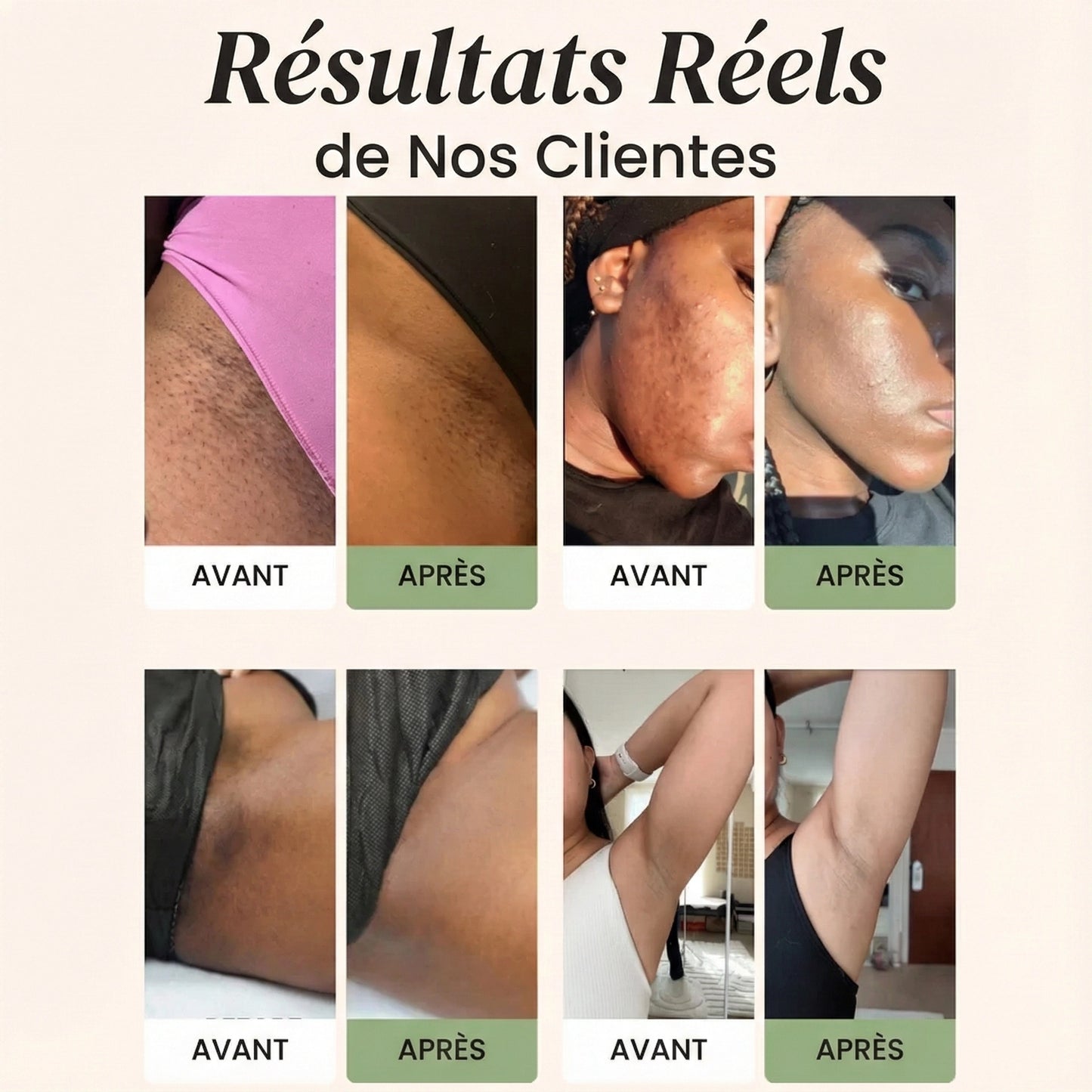 Savon au Curcuma et à l'Acide Kojique