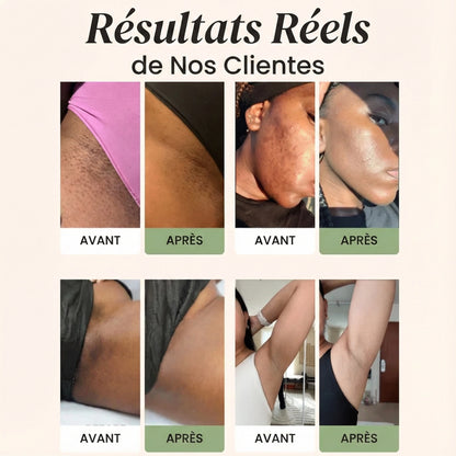 Savon au Curcuma et à l'Acide Kojique